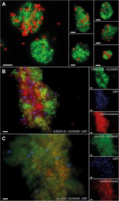 The Bacterial Microbiome of the Long-Term Aquarium Cultured High-Microbial Abundance Sponge Haliclona cnidata – Sustained Bioactivity Despite Community Shifts Under Detrimental Conditions